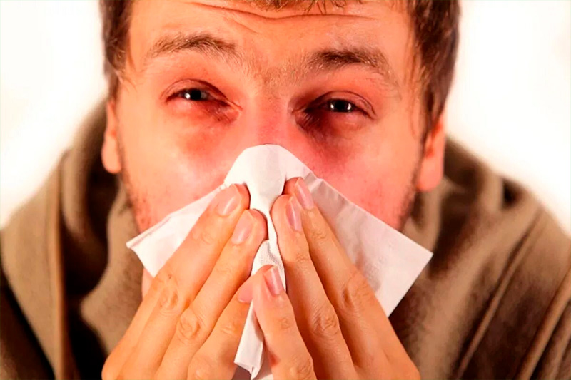 Как диагностируют аллергию